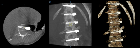 OEC_3D_image